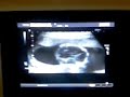 VIDEO_002.mp4 VIDEO_002.mp4