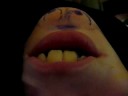 Chin head Fraser