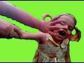 DAD RIPS GIRLS ARM OFF! (2/23/10-356) Part 1