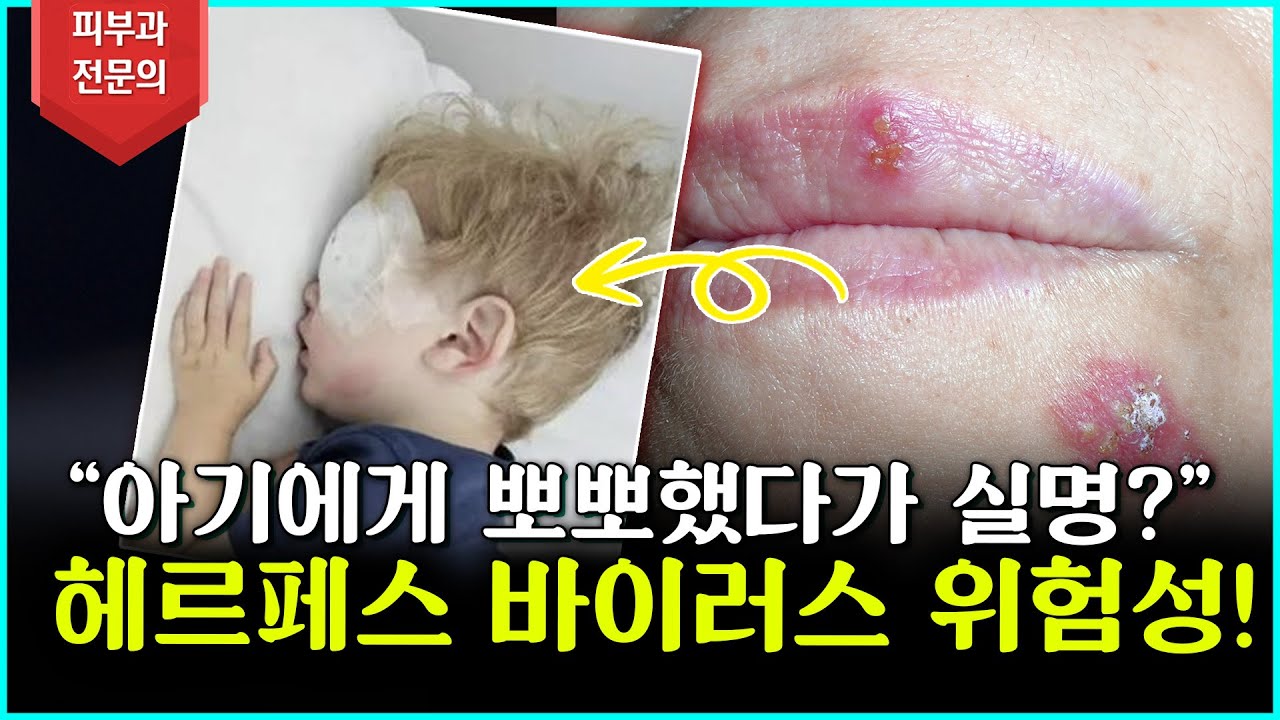 연세스타피부과 TV