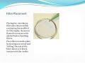 Wastewater E coli with Modifed m TEC prepared media plate