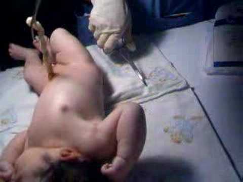 Zobacz wideo