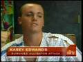 Fla. Teen Loses Arm To Gator