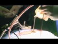 rughernia operatie door middel van de micro tube methode