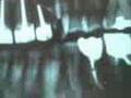 videos de dentiste, massacre,dentaire
