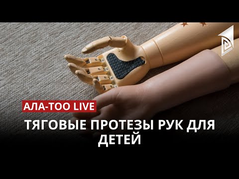 Тяговые протезы рук для детей | 24.04.2023
