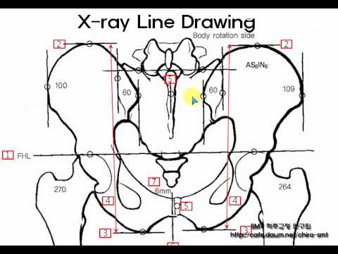 how to draw x ray