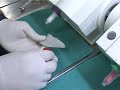 part-2-nobel-guided-implantscal-prosthesis-stumpel-dds.html