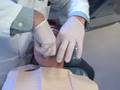 Braces off - removing Matthew's braces at Braces by Bergh in Glendale, CA by Dr. Brian H. Bergh, DDS, MS