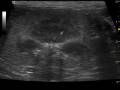 videos de Canine renal failure secondary to melamine toxicity in Chinese dog food
