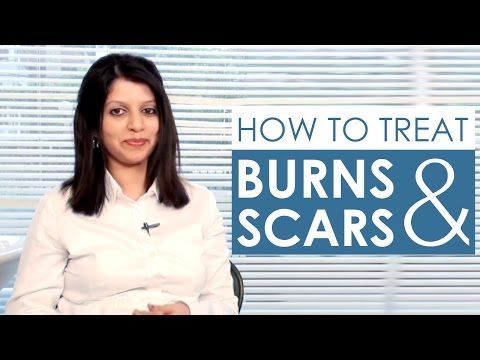 how to treat scars from a burn