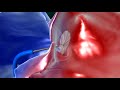 NHS PFO Device