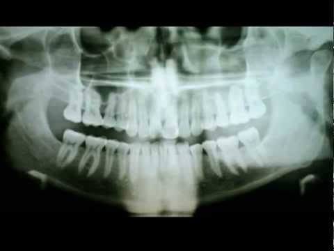 how to perform a dental x-ray