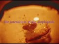 Scope On A Rope microscope video of amphipods