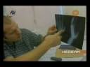 Fedor meets Wanderlei Silva Old hand injury You dont pick on Fedor at training