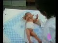 10. Moro reflex-