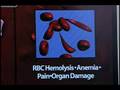 Sickle Cell Disease Causes Much More Pain Than Thought