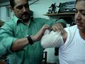 VENDAJE AMPUTACIÓN TRANSHUMERAL 1