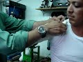VENDAJE AMPUTACI�N TRANSHUMERAL 1
