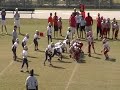 SV vs SB - Defensive Play with injury