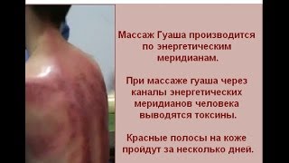 Массаж гуаша и сколько стоит Массаж гуаша и сколько стоит