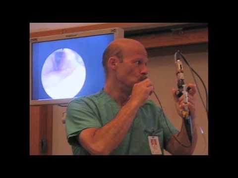 how to perform awake fiberoptic intubation