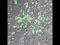 Live apoptosis of stem cells with cisplatin