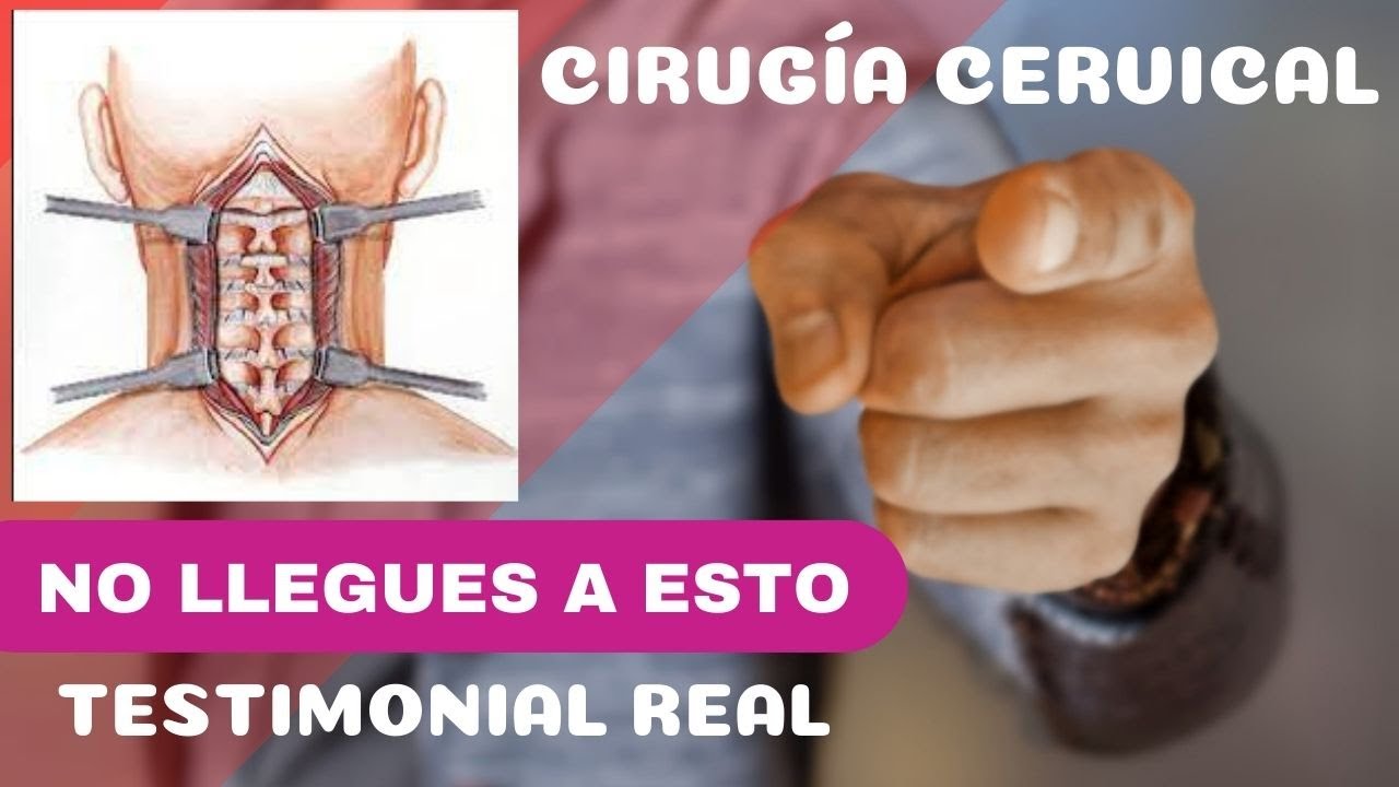 Creyó que la cirugía era su única opción