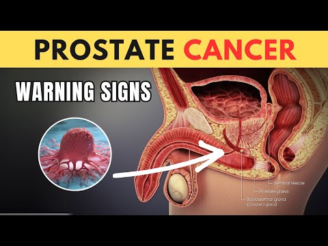 The PROSTATE CANCER Signs I Wish I Knew Sooner!