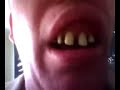 Dental Floss