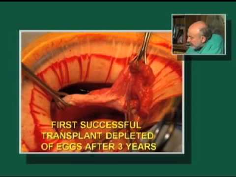 how to get an ovary transplant