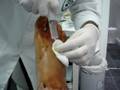 anestesia