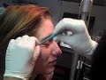 microdermal by the eye chassity la body art