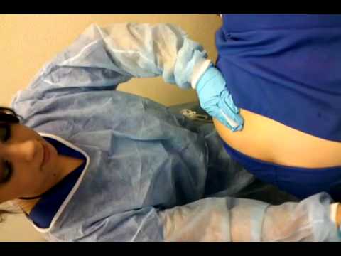 ass injections