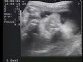 Pro-Life DVD - Eyewitness to the Earliest Days of Life Pro-Life DVD - Eyewitness to the Earliest Days of Life