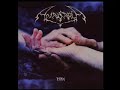Anasarca - Anopheles Anasarca - Anopheles