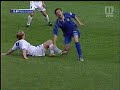 broken leg