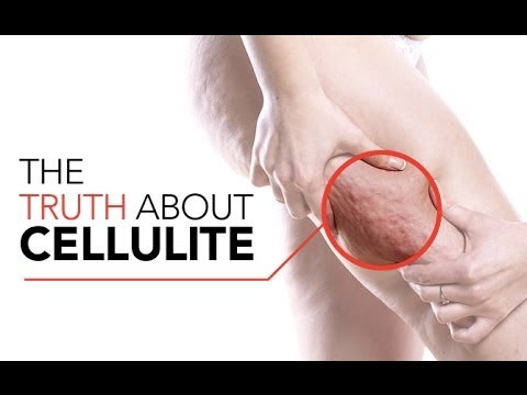 how to i get rid of cellulite