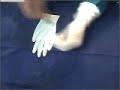 Colocaci�n de guantes para cirug�a