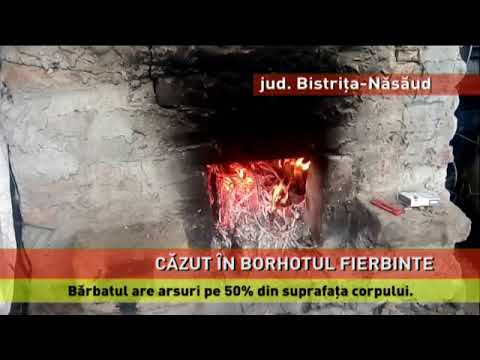 Bărbat cu arsuri grave, după ce a căzut în borhot fierbinte