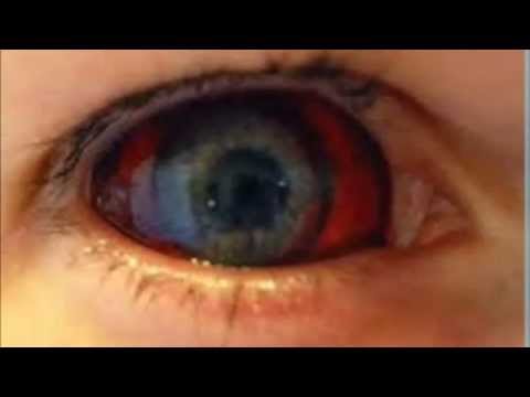 how to avoid ebola virus