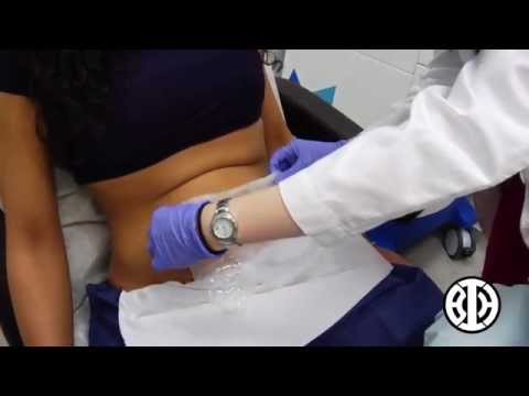 how to get rid of lower ab skin