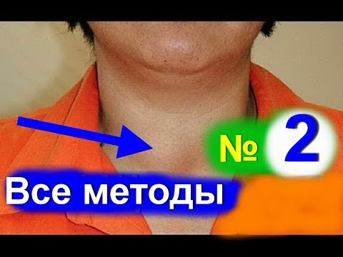 Зоб лечение народными средствами в домашних условиях