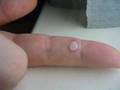 Formule W - Wart remover