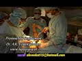 www.hipsurgery.in- Proxima hip replacement video, India www.hipsurgery.in- Proxima hip replacement video, India
