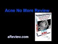 Acne No More Treatment - Clinically Proven