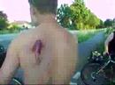 leckere-verletzung-nach-dummem-sturz.html