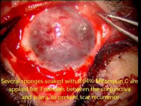 how to dissolve mitomycin c