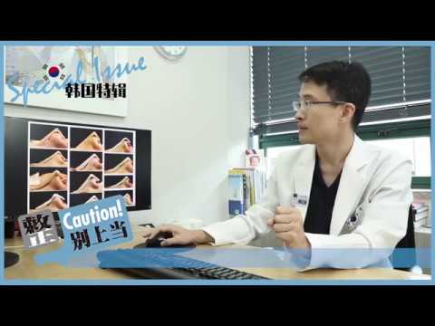 코성형수술 및 프로파일 변화 (에스원 프로파일성형)