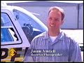 Glenn Kawesch Radial Keratotomy